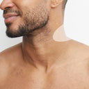 Fat Reduction: Back Neck: (Prepay 3 x $184.50)