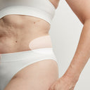 Fat Reduction: Love Handles