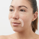 HIFU: Nasal Folds: Prepay 4 x $149.50