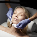 Dermal Peels: Jessner: Prepay 4 x $99.50