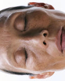 4 Minimally Invasive Pigmentation Removal Treatments