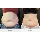 CRISTAL® Fat Freezing: Lower Abs (Prepay 6 x $174.50)