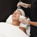 Dermal Peels: Lactic: Prepay 4 x $74.50