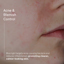 Lumedica LED Mask Pro