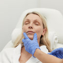 HIFU: Perioral (Mouth/Smokers Lines)