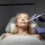 Microneedling: Body Area (A5)