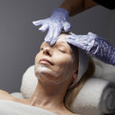 Dermal Peels: Jessner: Prepay 4 x $99.50